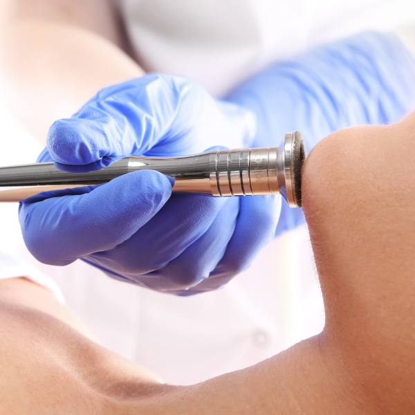 Dermoabrasión Dermoabrasión