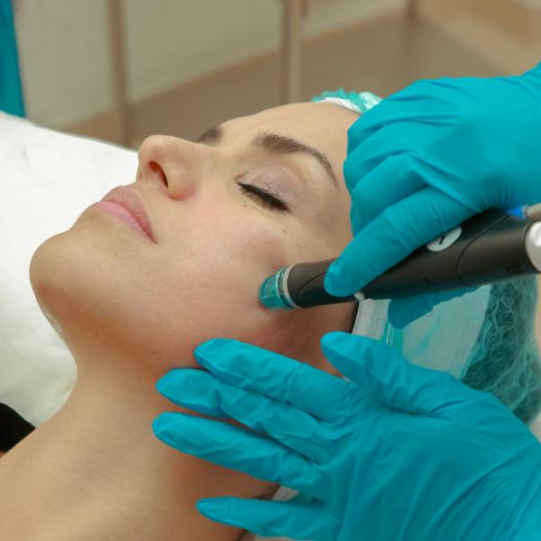 Implante facial Implante facial