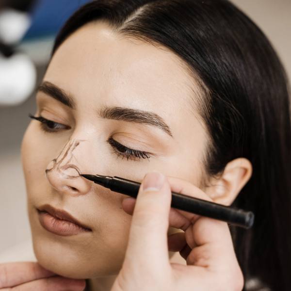 Rinoplastia Rinoplastia