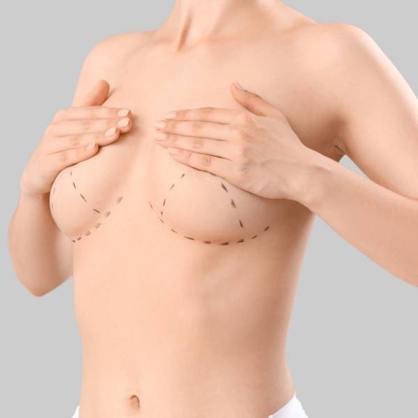 correccion de asimetría correccion de asimetría